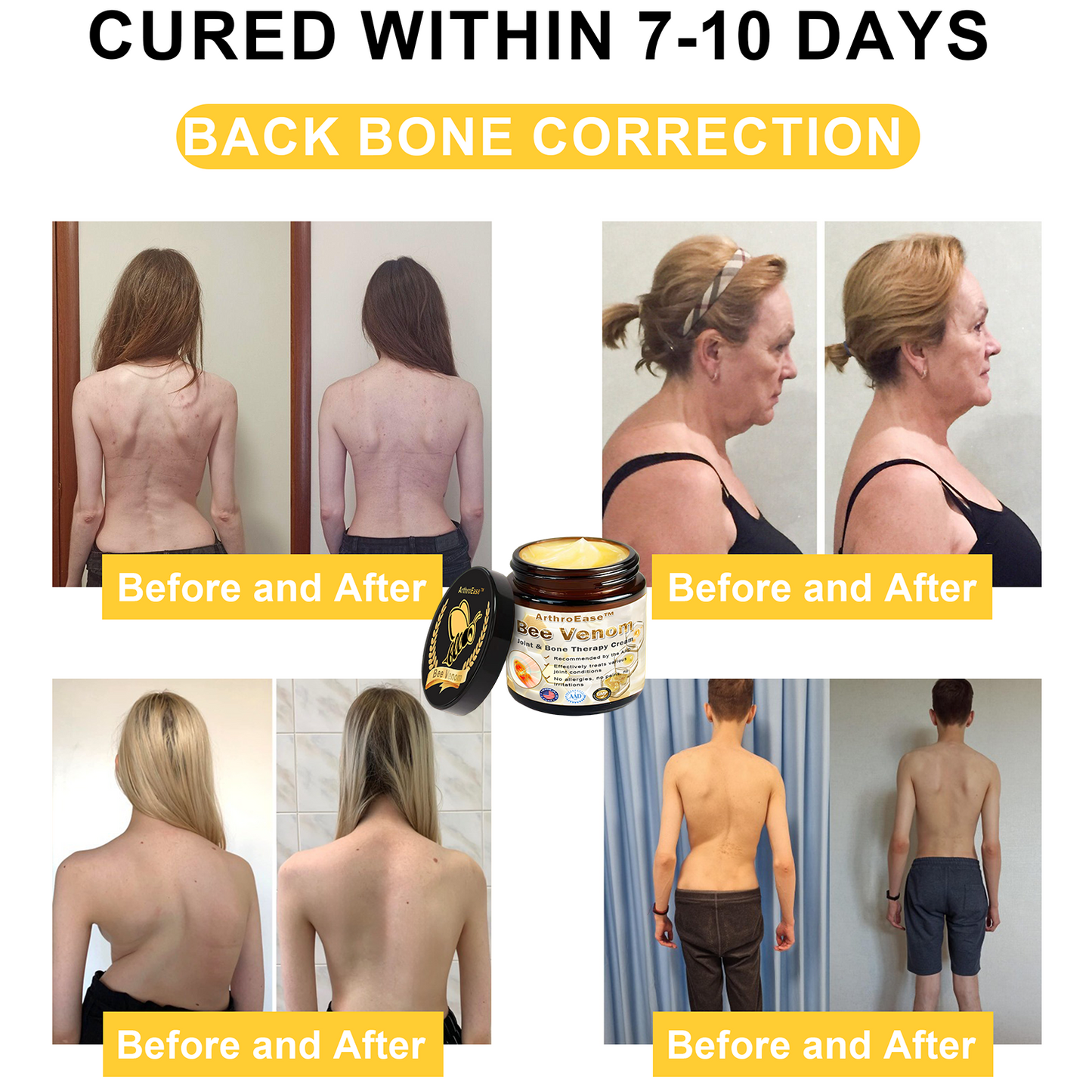 𝐒𝐩𝐳𝐯™ Bee Venom Arthritis Therapy Cream(Specially for older adults & AAOS recommends)💜