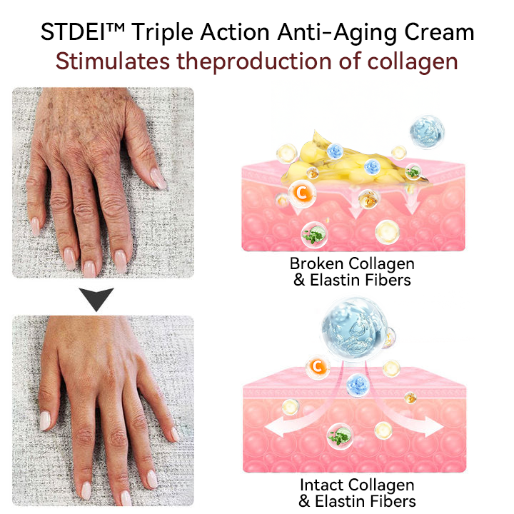 💐𝐒𝐓𝐃𝐄𝐈™ 𝐓𝐫𝐢𝐩𝐥𝐞 𝐀𝐜𝐭𝐢𝐨𝐧 𝐀𝐧𝐭𝐢-𝐀𝐠𝐢𝐧𝐠 𝐂𝐫𝐞𝐚𝐦(🔥74% Off for a Limited Time!)