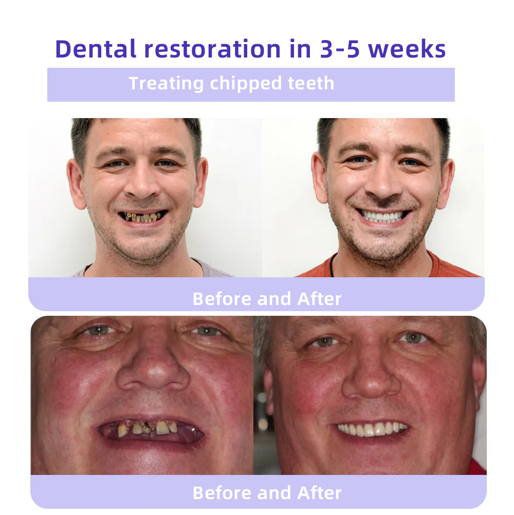 Oyikey ™Teeth Restoration Mineral Powder 💜
