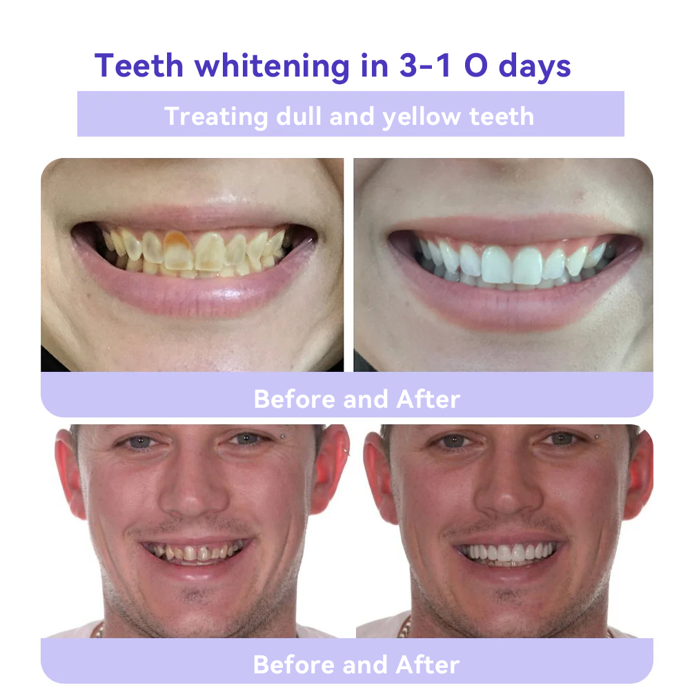Oyikey ™Teeth Restoration Mineral Powder 💜