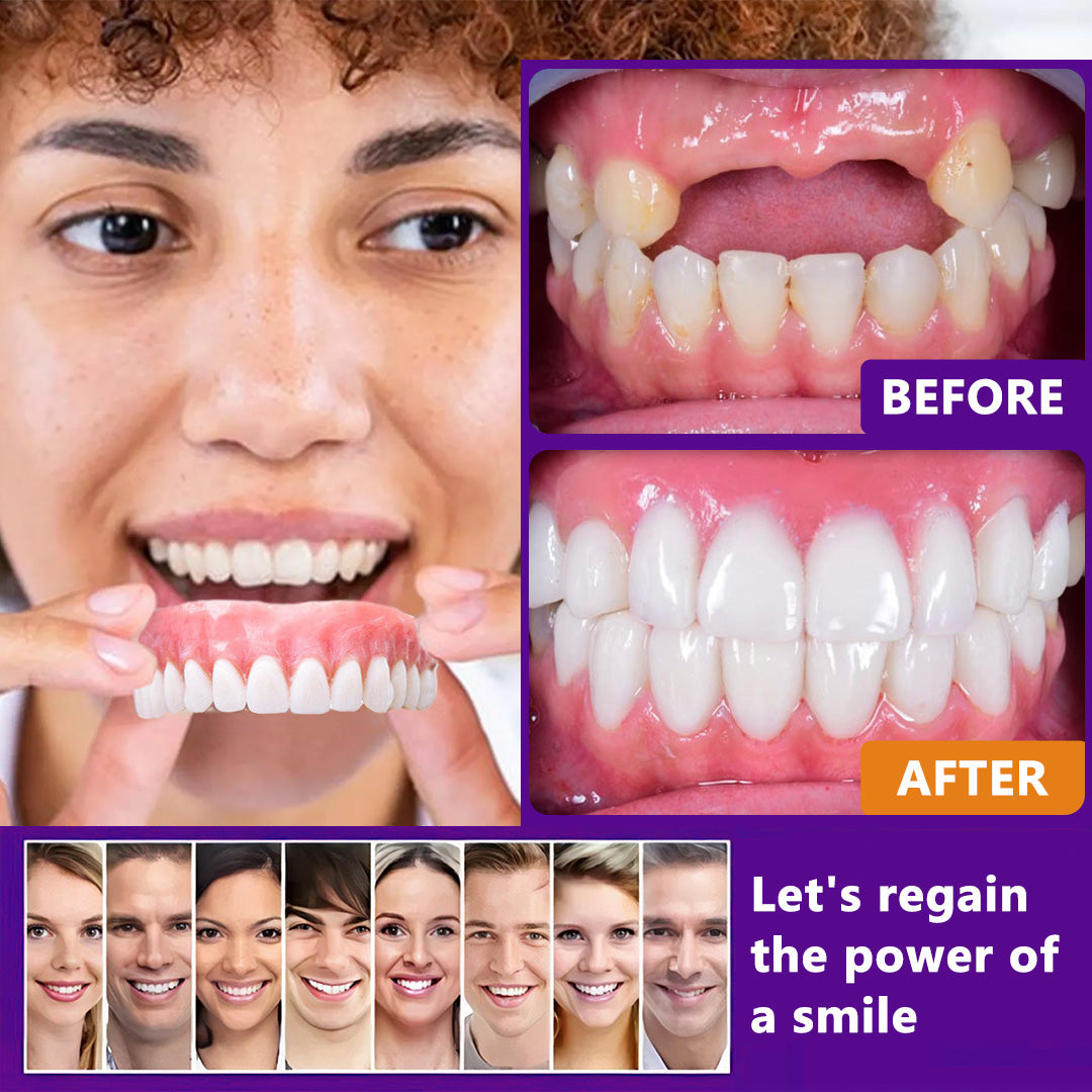 ๐๐ข๐ค๐๐ง๐๐โข๐ Silicone Reline Denture Set (โฐ Limited Time Discount Last 30 Minutes โฐ)