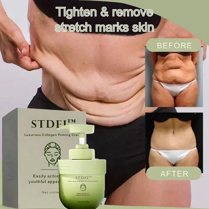 STDEI™ 🎄 Luxurious Collagen Firming Cream (🔥 50% Off for a Limited Time!)