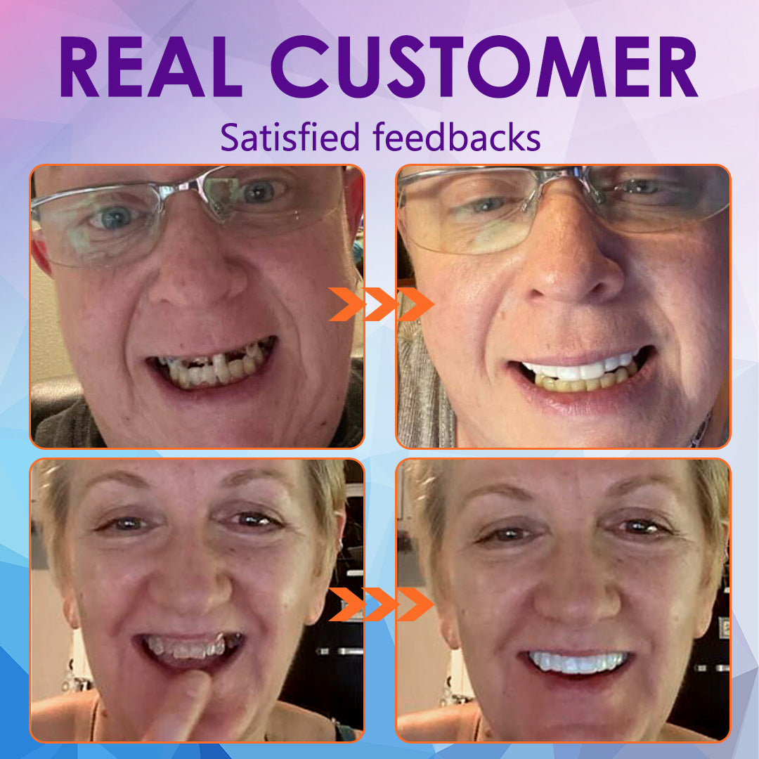 ๐๐ข๐ค๐๐ง๐๐โข๐ Silicone Reline Denture Set (โฐ Limited Time Discount Last 30 Minutes โฐ)