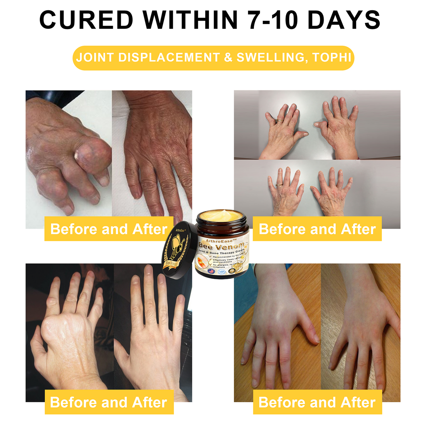 𝐒𝐩𝐳𝐯™ Bee Venom Arthritis Therapy Cream(Specially for older adults & AAOS recommends)💜