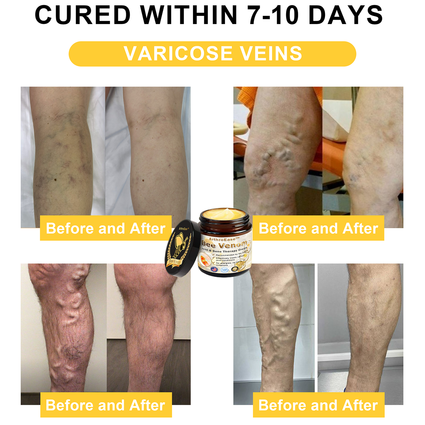 𝐒𝐩𝐳𝐯™ Bee Venom Arthritis Therapy Cream(Specially for older adults & AAOS recommends)💜