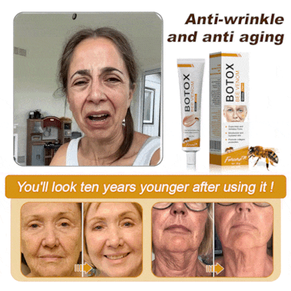 (🎁 Made and Shipped from the UK ✅) 𝐒𝐩𝐳𝐯™ 𝐁𝐨𝐭𝐨𝐱 Bee Venom Wrinkle Removal Cream - LAST DAY 70% OFF