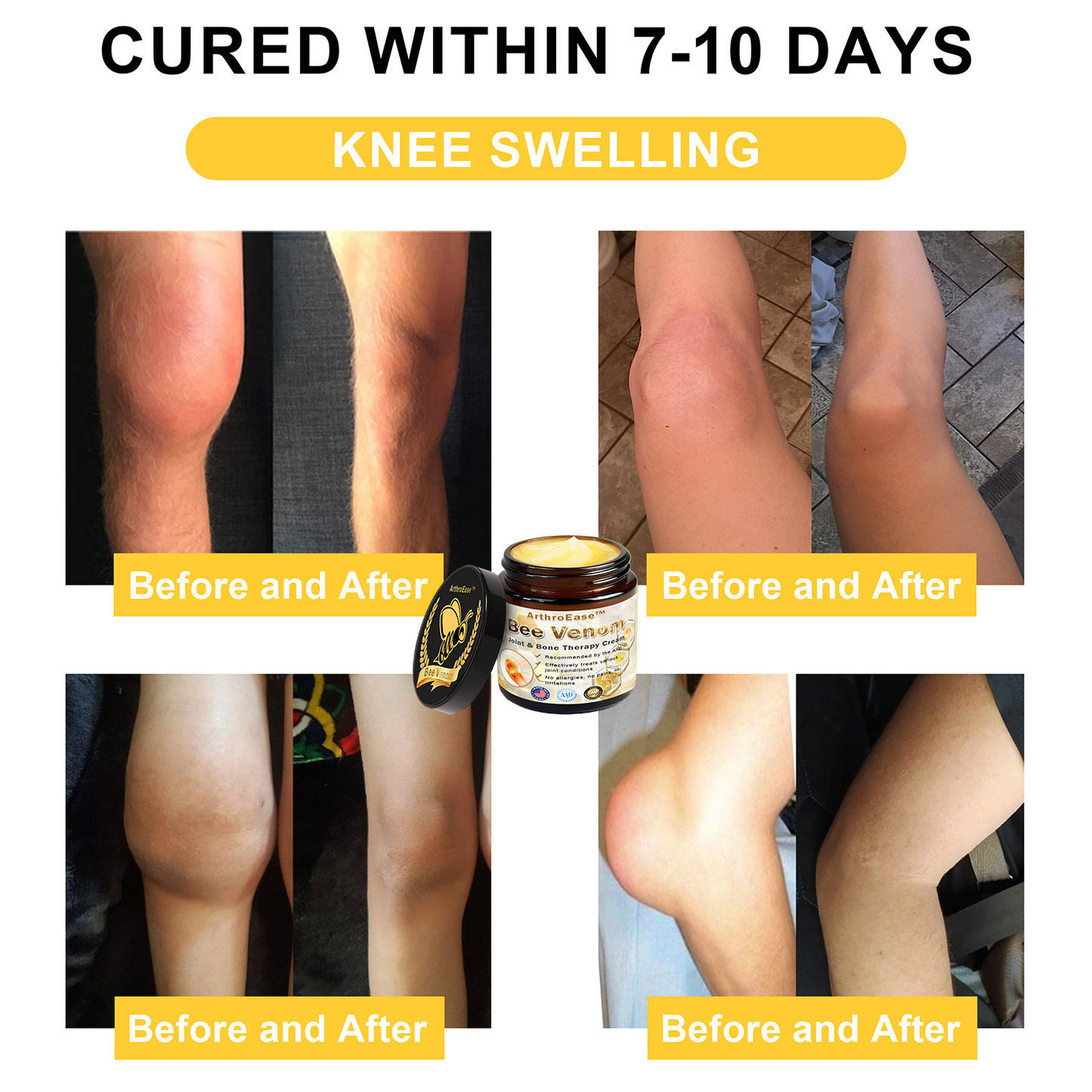 𝐒𝐩𝐳𝐯™ Bee Venom Arthritis Therapy Cream(Specially for older adults & AAOS recommends)💜