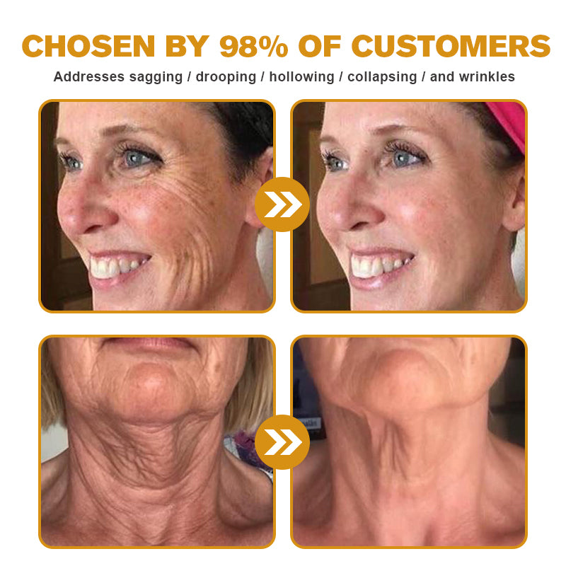 (🎁 Made and Shipped from the UK ✅) 𝐒𝐩𝐳𝐯™ 𝐁𝐨𝐭𝐨𝐱 Bee Venom Wrinkle Removal Cream - LAST DAY 70% OFF