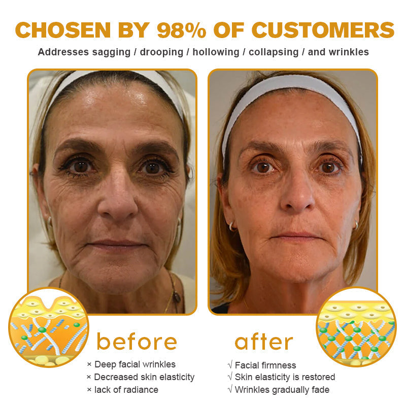 (🎁 Made and Shipped from the UK ✅) 𝐒𝐩𝐳𝐯™ 𝐁𝐨𝐭𝐨𝐱 Bee Venom Wrinkle Removal Cream - LAST DAY 70% OFF