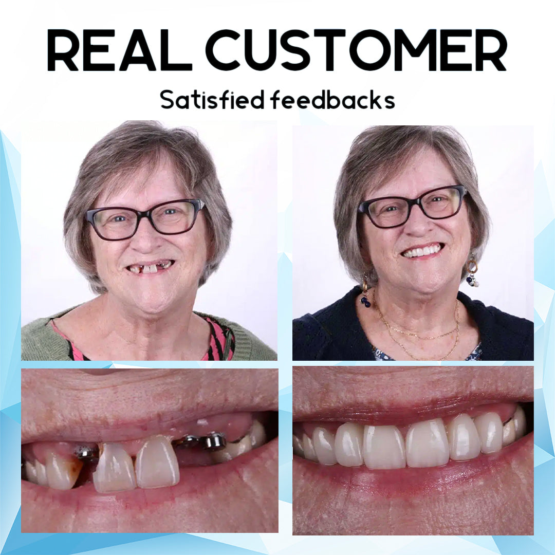 🔥 Only the last 4 boxes left! Extra 50% off! Tested by the UK's top dental experts to fit a wide range of mouth shapes, ensuring a perfect fit and comfort. Don't miss this opportunity, wait another year if you miss it! 💥