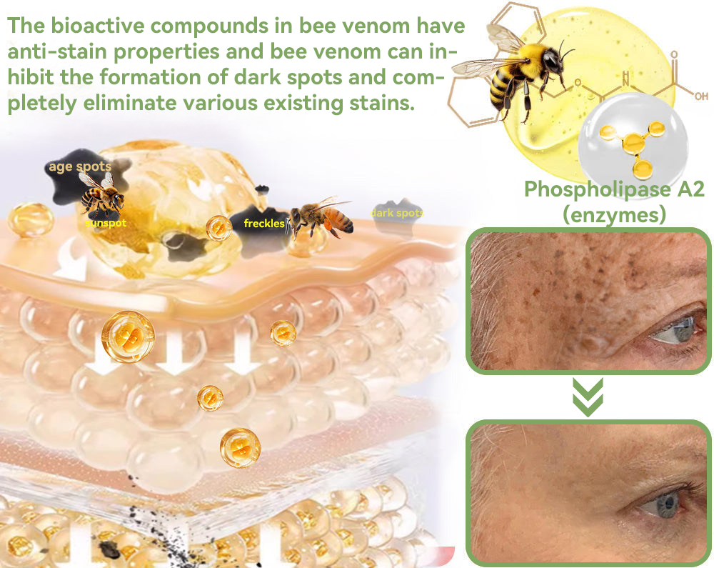 𝐒𝐓𝐃𝐄𝐈™ 𝐈𝐧𝐭𝐞𝐧𝐬𝐞 𝐅𝐮𝐥𝐥 𝐁𝐨𝐝𝐲 𝐒𝐤𝐢𝐧 𝐂𝐚𝐫𝐞 𝐂𝐫𝐞𝐚𝐦🏆(BAD) British Academy of Dermatology💎