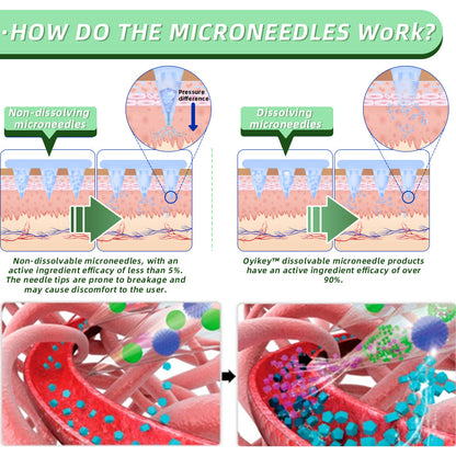 [See results in 7 days]🌲0yikey™ SMGT-GLP-1 Nano Microneedle Patch（Painless, long-lasting, addressing diabetes, obesity, and cardiovascular diseases）