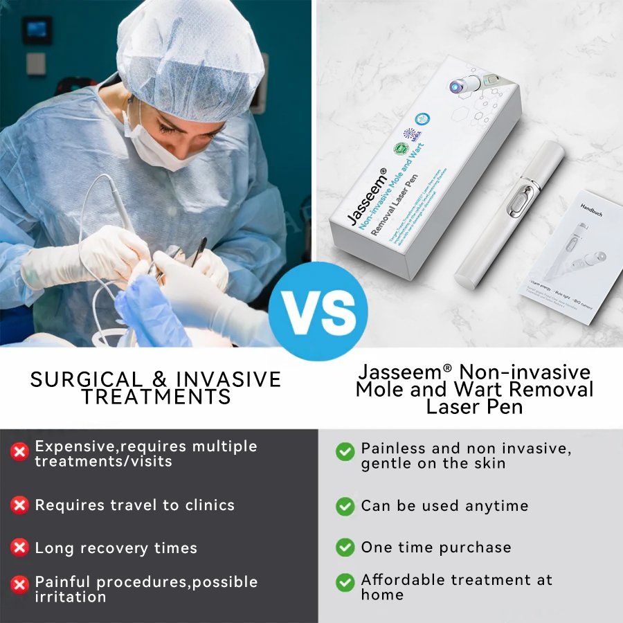 [Visible results in just 7 days]💧𝐉𝐚𝐬𝐬𝐞𝐞𝐦® Non-invasive Mole and Wart Removal Laser Pen (Quick and painless removal of warts, moles, age spots and skin tags - without any side effects)🫐