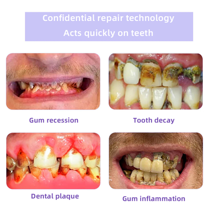 Oyikey ™ 💥💥 Teeth Restoration Mineral Powder(BDA ecommended).