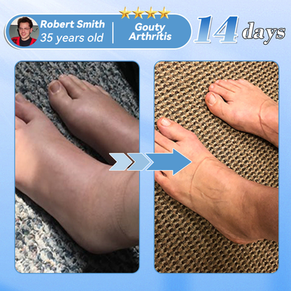 Official Store：✅Made and shipped from the UK💪Oyikey® Nano-microneedle joint patch