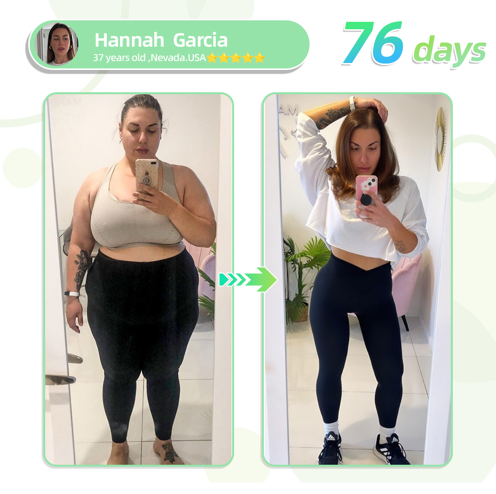 [See results in 7 days]🌲0yikey™ SMGT-GLP-1 Nano Microneedle Patch（Painless, long-lasting, addressing diabetes, obesity, and cardiovascular diseases）