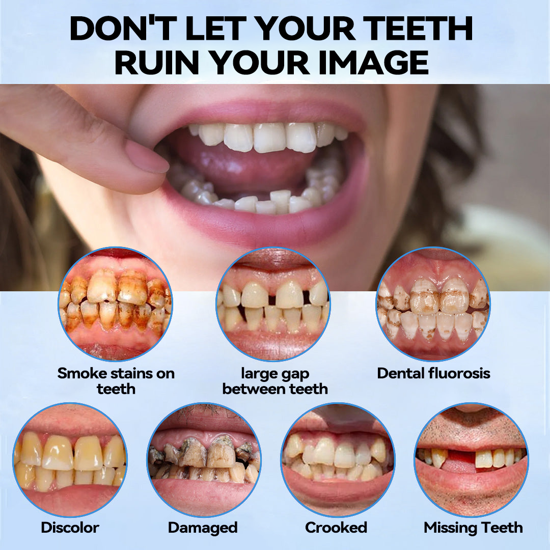 𝐁𝐢𝐤𝐞𝐧𝐝𝐚™🌉 Silicone Reline Denture Set (⏰ Limited Time Discount Last 30 Minutes ⏰)