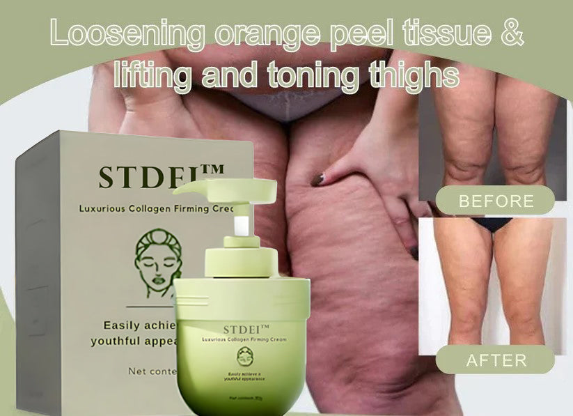 STDEI™ 🌹 Luxurious Collagen Firming Cream (🔥 50% Off for a Limited Time!)