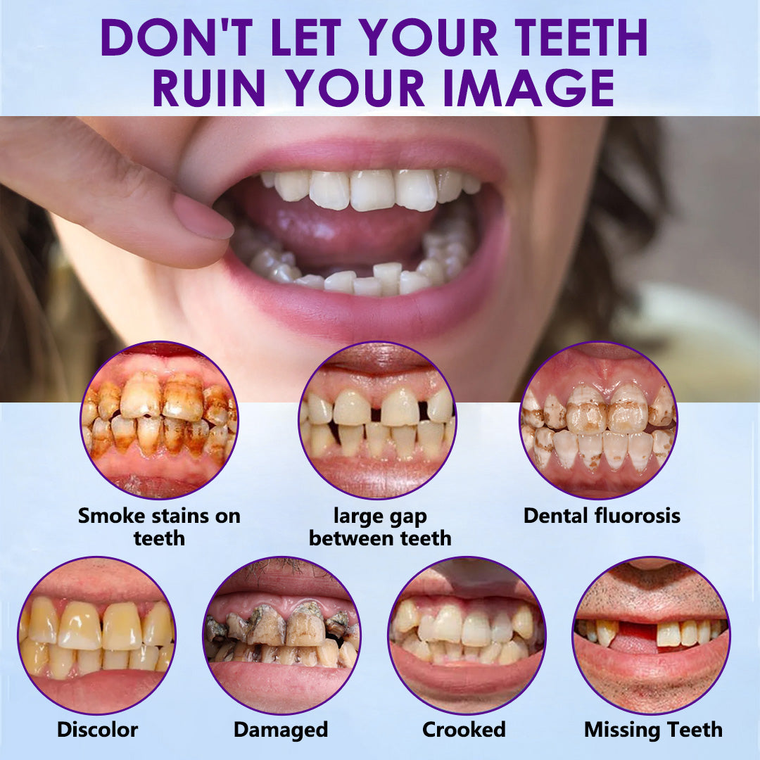 𝐁𝐢𝐤𝐞𝐧𝐝𝐚™🧸 Silicone Reline Denture Set (⏰ Limited Time Discount Last 30 Minutes ⏰)