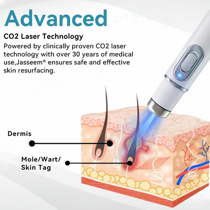 [Visible results in just 7 days]💧𝐉𝐚𝐬𝐬𝐞𝐞𝐦® Non-invasive Mole and Wart Removal Laser Pen (Quick and painless removal of warts, moles, age spots and skin tags - without any side effects)🫐